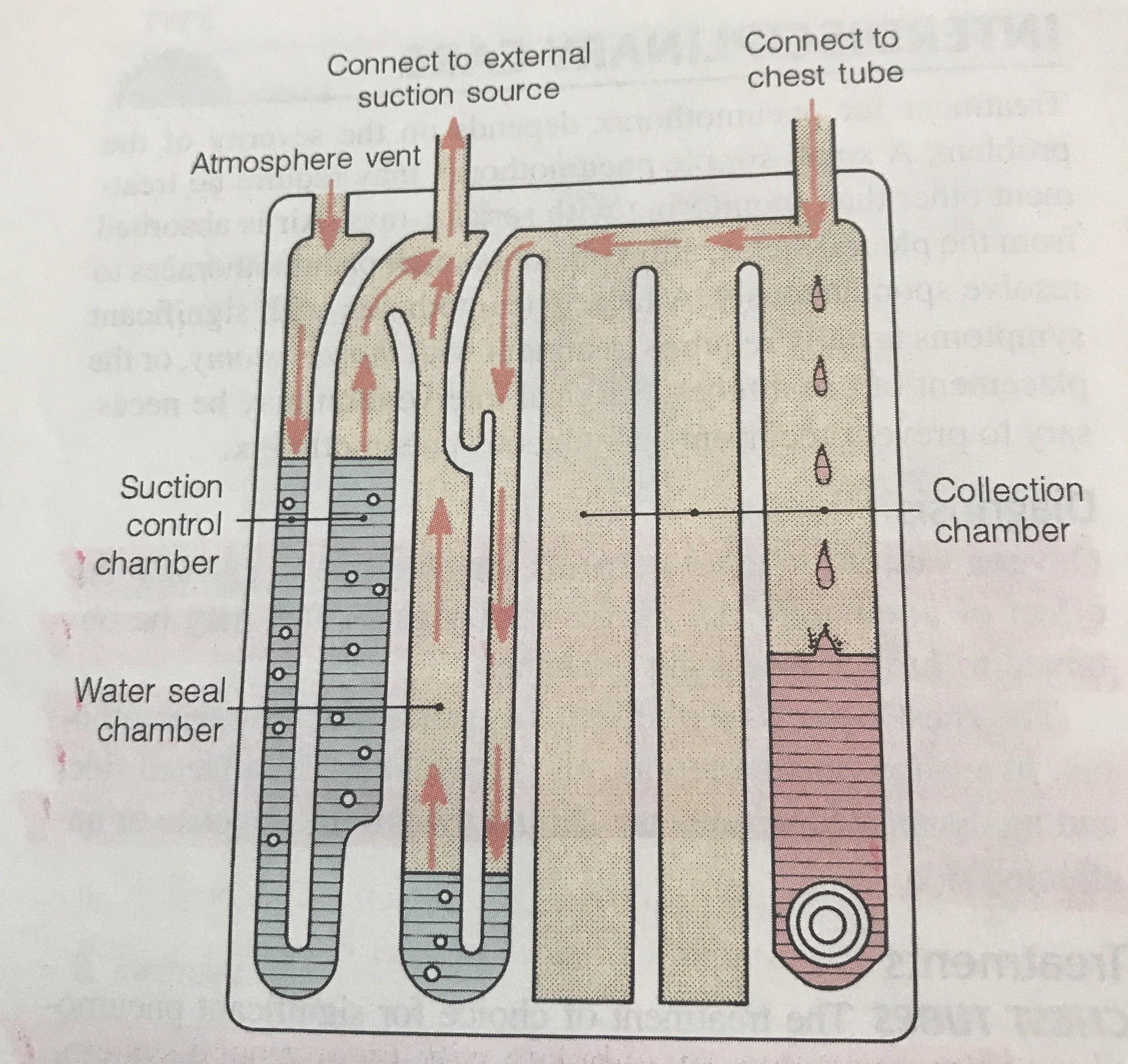 serous drainage in chest tube