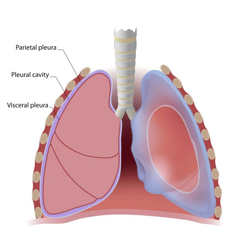 Chest Tubes Nursing Care CEU - Nursing CE Central