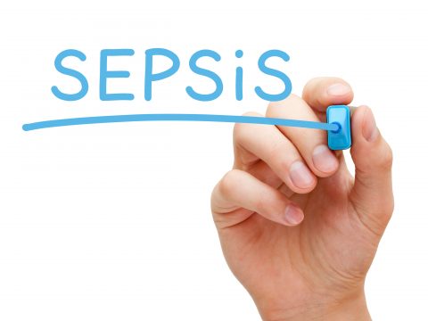 The One Hour Sepsis Bundle: How to Act in 60 Minutes