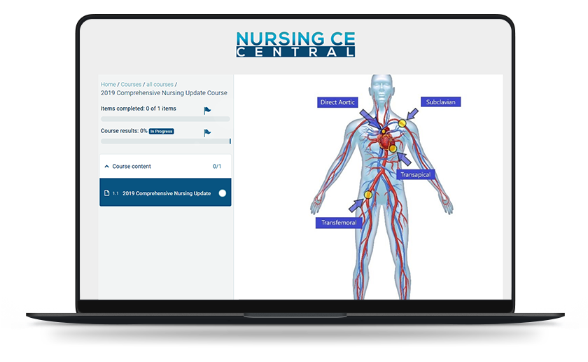 Laptop showing Nursing CE course
