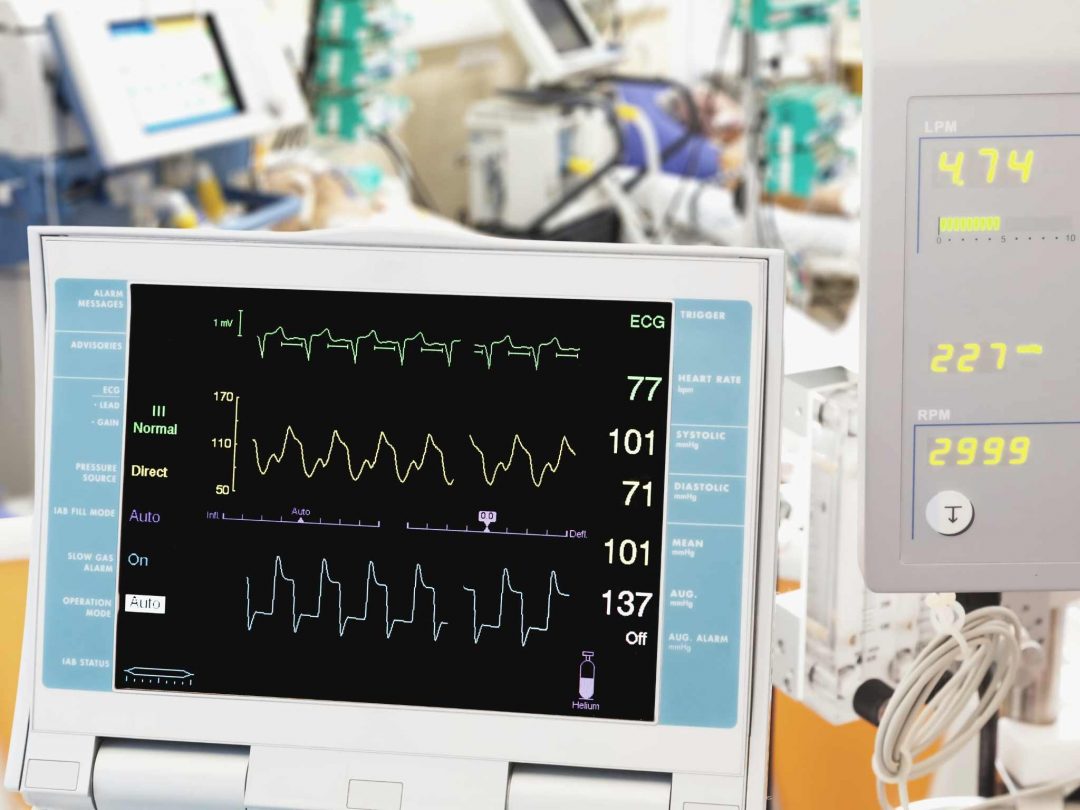 The Intense, Specialized, and Essential Role of an ECMO Nurse