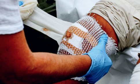 Negative Pressure Wound Therapy (Wound VAC)