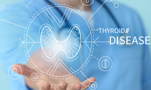 A Guide for Thyroid Disorders in the Elderly