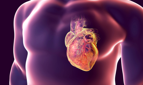 Let’s Discuss Angina Pectoris