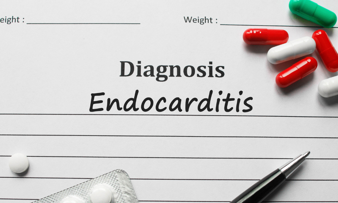 How to Prevent Cardiac Complications from Infective Endocarditis