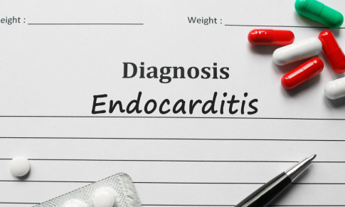 How to Prevent Cardiac Complications from Infective Endocarditis