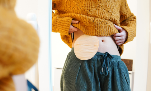 Ostomy Care: What Nurses Need to Know