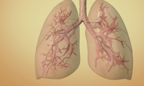 Differential Diagnosis of Pneumonia