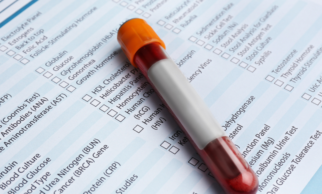 The Importance of Delivering Timely Test Results