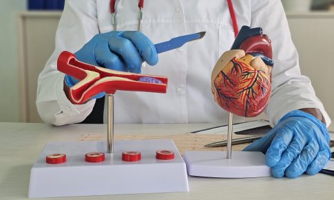 Coronary Stent Placement Beginners Guide