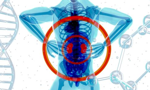 Polycystic Kidney Disease: Complications and Treatment