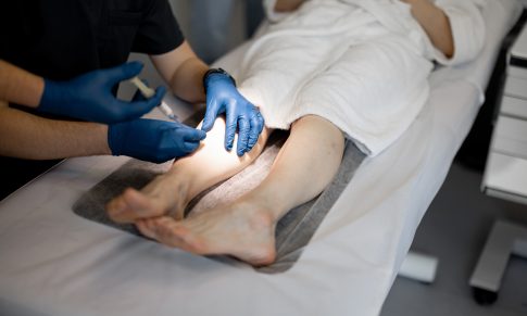 Aesthetic Nursing: Sclerotherapy