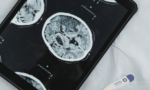 Temperature Management in Ischemic Stroke