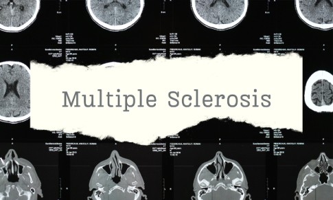 Understanding Multiple Sclerosis