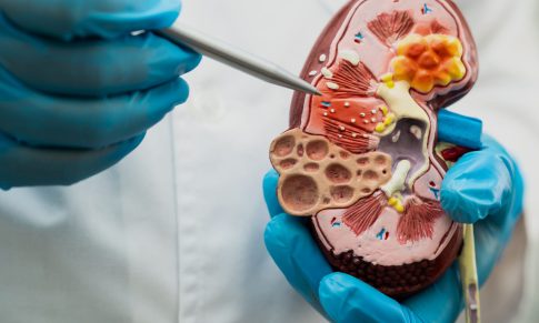 Diabetic Kidney Disease