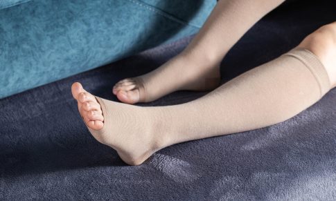 Lymphedema Management