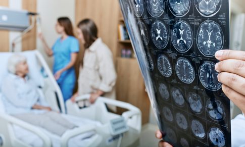 NIH Stroke Scale and Neuro Assessment