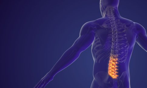 Spinal Fusion Surgery and Aftercare