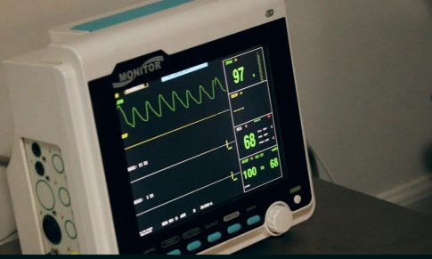 Transcutaneous Pacing Review