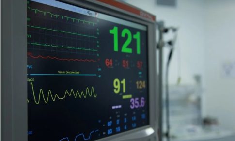 End Tidal CO2 and Waveform Capnography