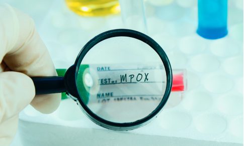 Mpox (monkeypox) Overview
