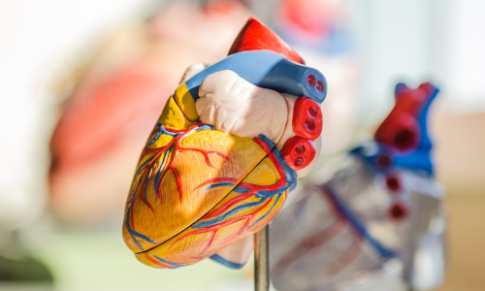 Stress Cardiomyopathy