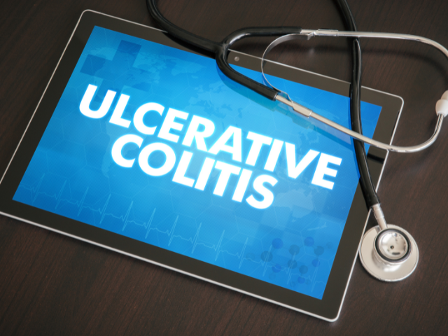 Treating ulcerative colitis