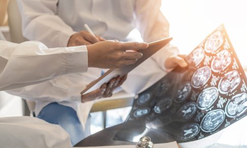 Time is Brain: Door-to-Needle Time