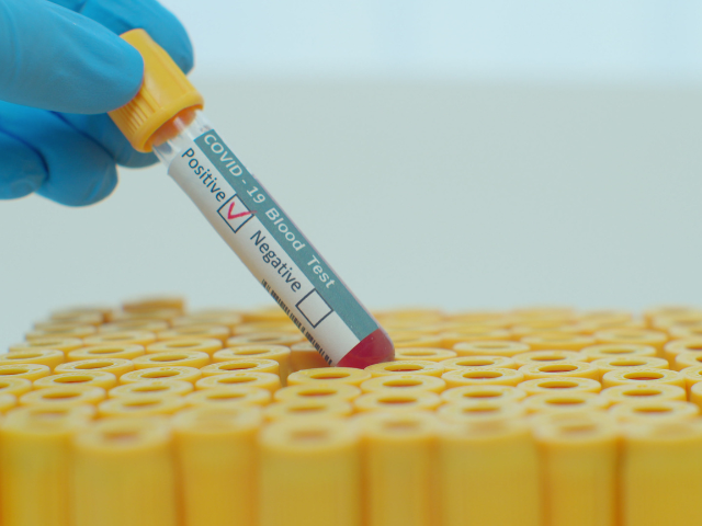 A positive COVID-19 blood test in a vial.